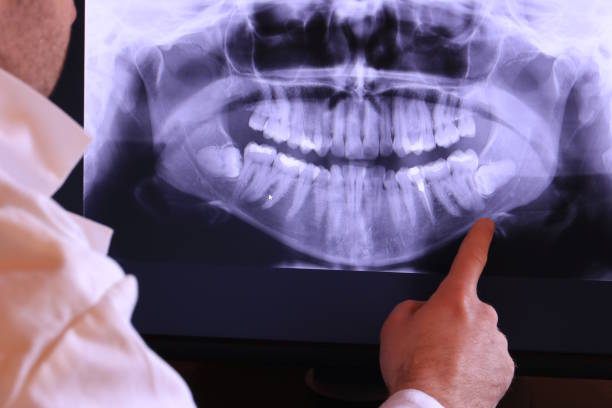 Best Emergency TMJ Treatment in North Conway, NH